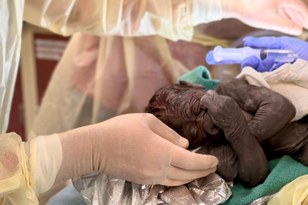 Gorilla in Seattle zoo undergoes rare emergency C-section to deliver baby