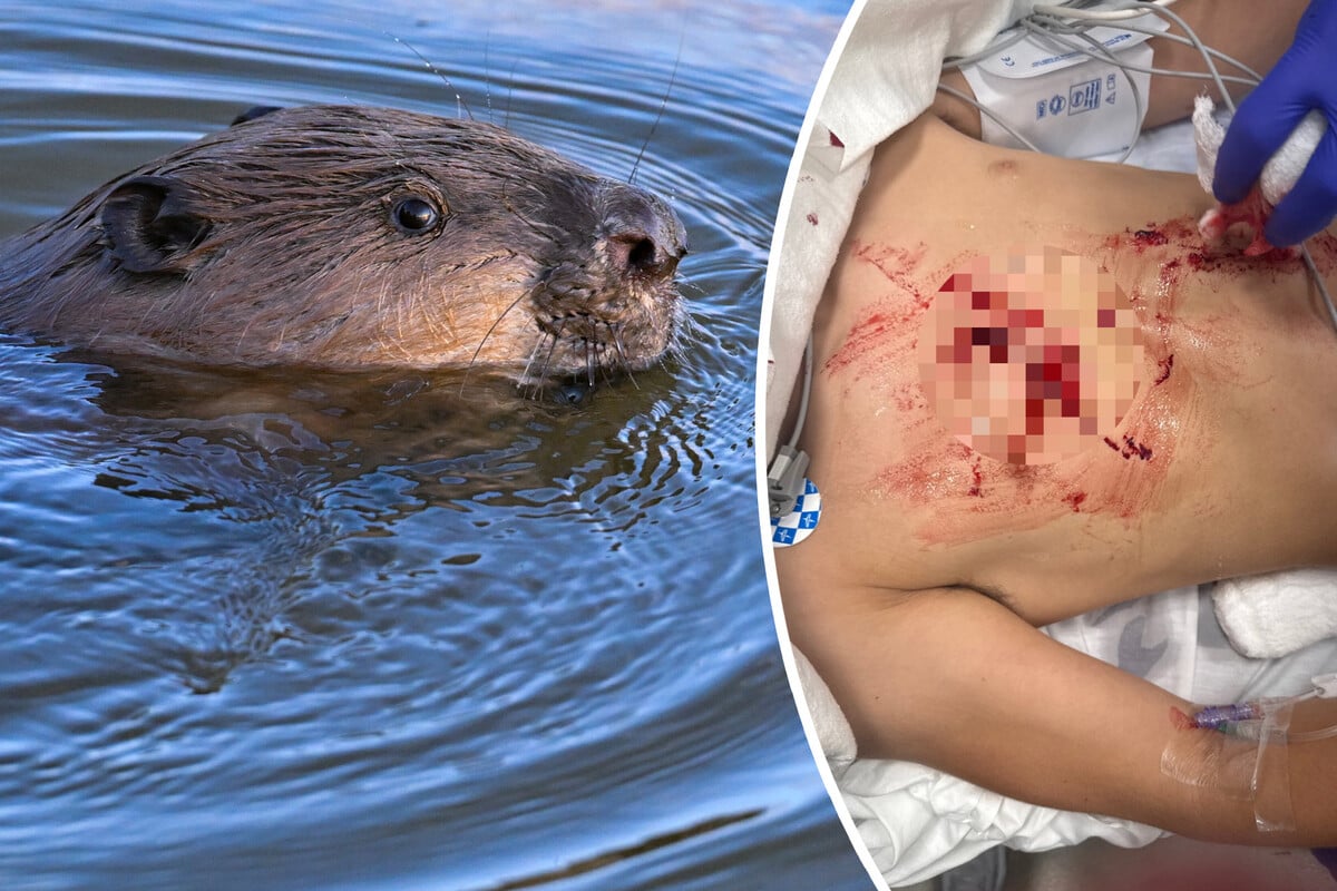 Rabid beaver viciously attacks 13-year-old boy in a state park: "It was so traumatic"