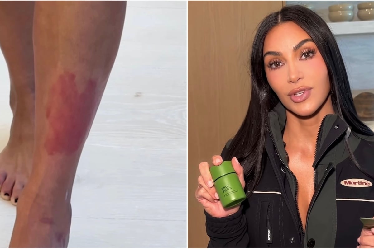 Kim Kardashian backs new Broc Shot after years of dealing with "unbearable" psoriasis