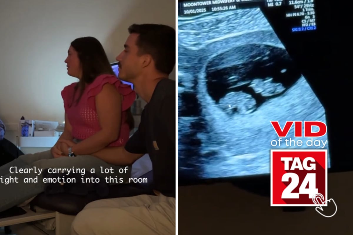 Viral Video of the Day for October 4, 2026: Couple who lost baby at 34 weeks gets heartfelt surprise at next ultrasound!
