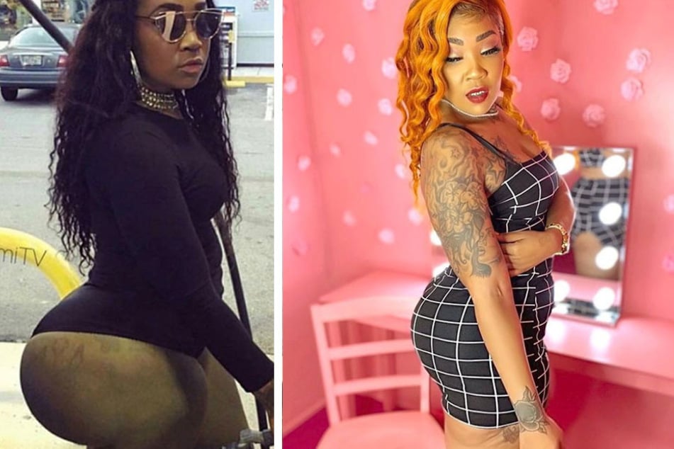 "Ms. Miami" reshapes her butt, and her life, after illegal injections kerfuffle