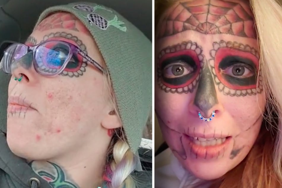 Woman with jarring face tattoos endures painful removal sessions for a fresh start