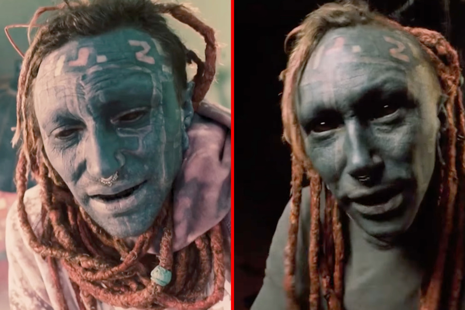 Extreme body mod artist tattoos client's grey eye white in radical procedure