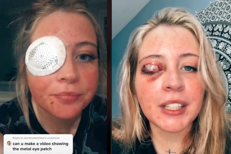Bad dog! Woman gets maimed by beautician's chihuahua after getting her eyelashes done