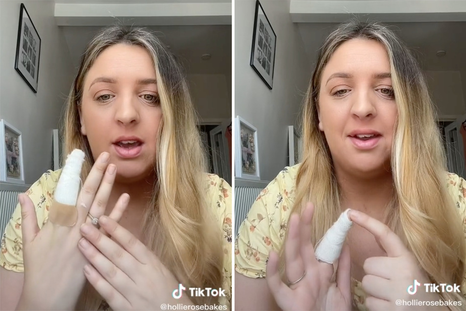 Hollie had the lump on her finger surgically removed.