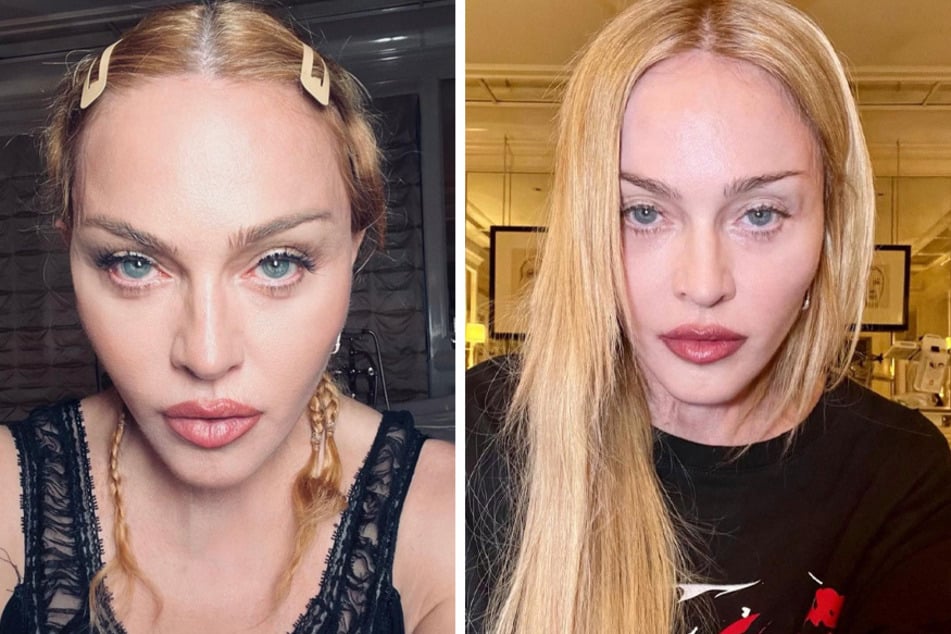 Madonna breaks silence following hospitalization: "I hate to disappoint"