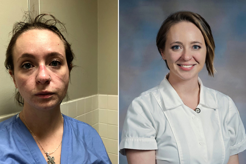 Before and after: nurse reveals what the pandemic has done to her