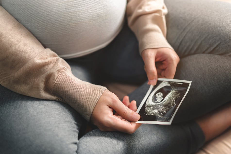Covid-19 contributed to the spike in maternal mortality in the US in 2021.