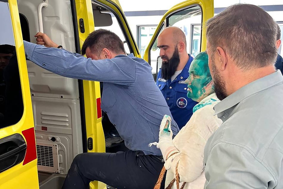 Novaya Gazeta investigative reporter Elena Milashina has been hospitalized in Moscow after being badly beaten bu attackers in Chechnya.