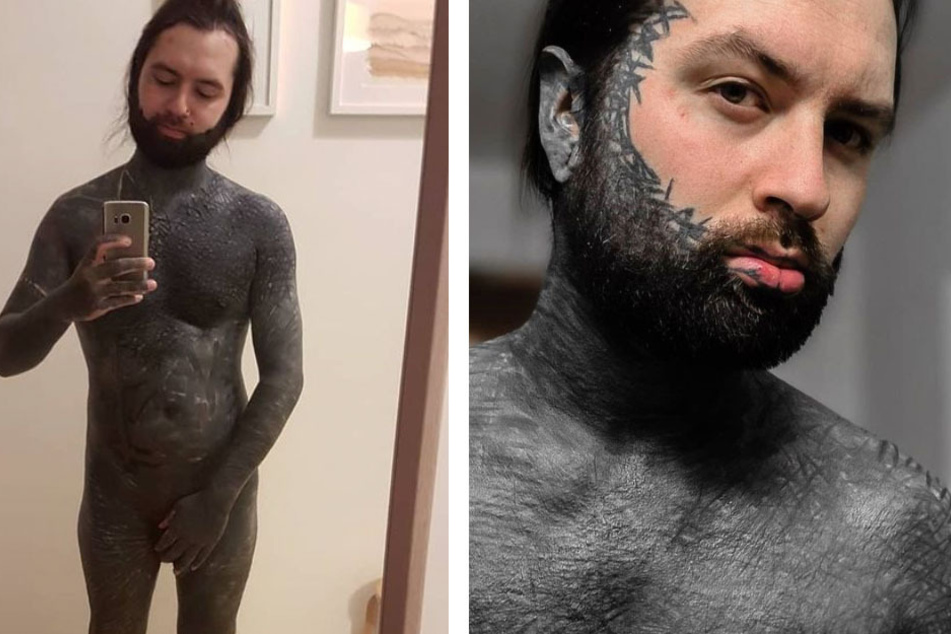 Yannick Rick has spent over 400 hours getting blackout tattoos.