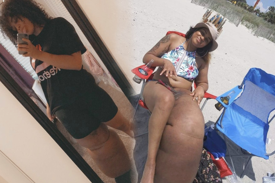 Inspiring model Mahogany Geter overcomes the lymphedema that made her leg 100 pounds, and slaps back at haters