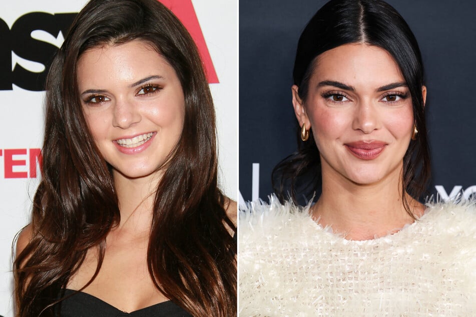 Kendall Jenner said "baby Botox" is the only plastic surgery she's ever had.