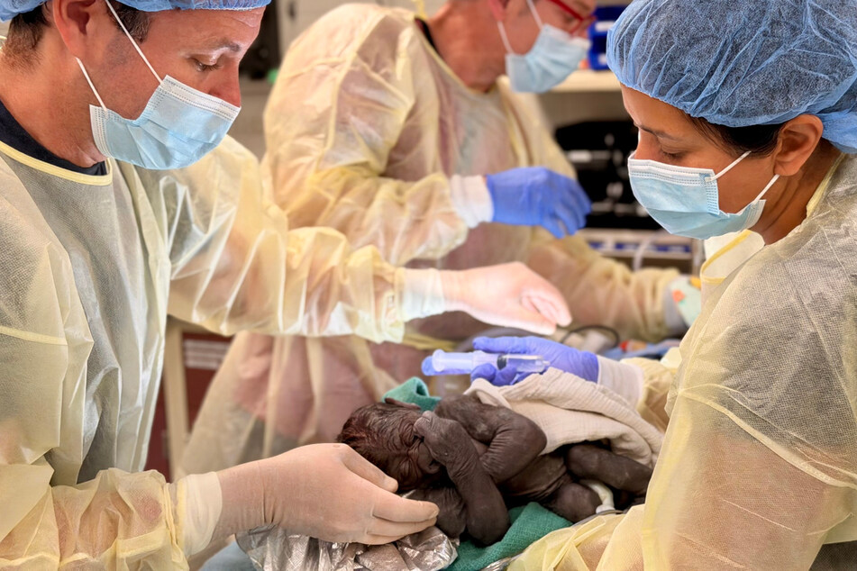 A medical team has successfully delivered a baby gorilla from Seattle’s Woodland Park Zoo via cesarean section.