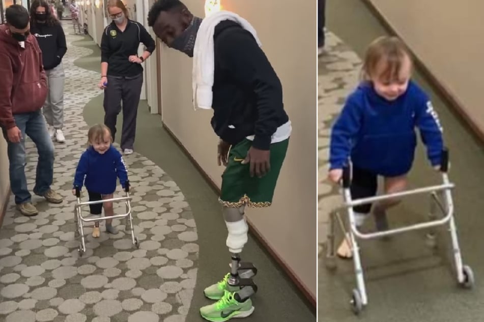 Paralympic athlete helps 2-year-old try out prosthetic leg for first time