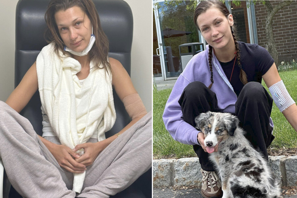 Bella Hadid updates fans on her modeling future amid Lyme disease struggles