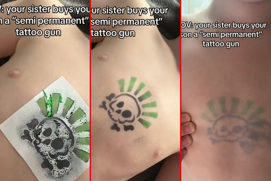 Mom left desperate after son gets "temporary" tattoo that was more permanent than expected