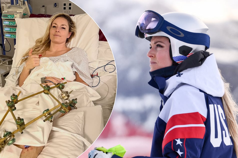 Lindsey Vonn undergoes third surgery for leg injury from devastating Olympics crash