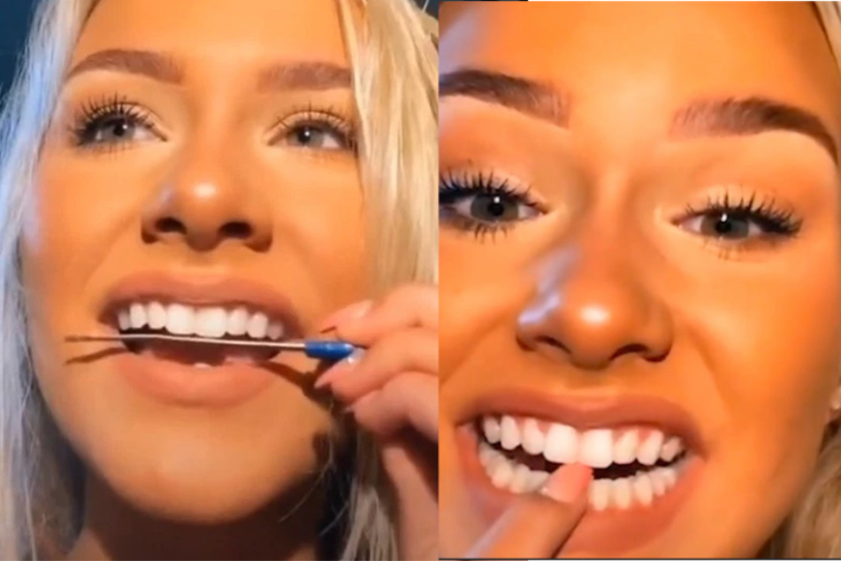 Don't try this TikTok trend! Dentists warn against DIY teeth filing