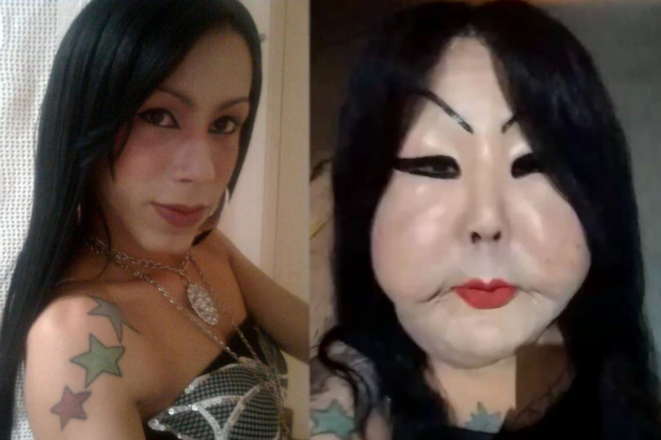 Juju Oliveira's Illegal plastic surgery left her begging for money to fix her face