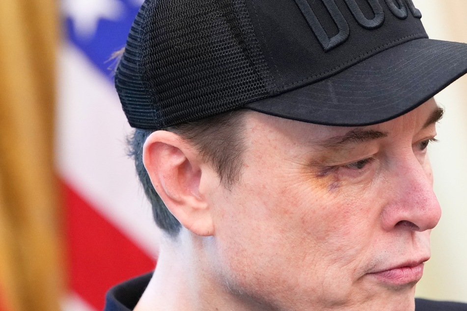 Elon Musk spills the story behind his black eye at Oval Office farewell