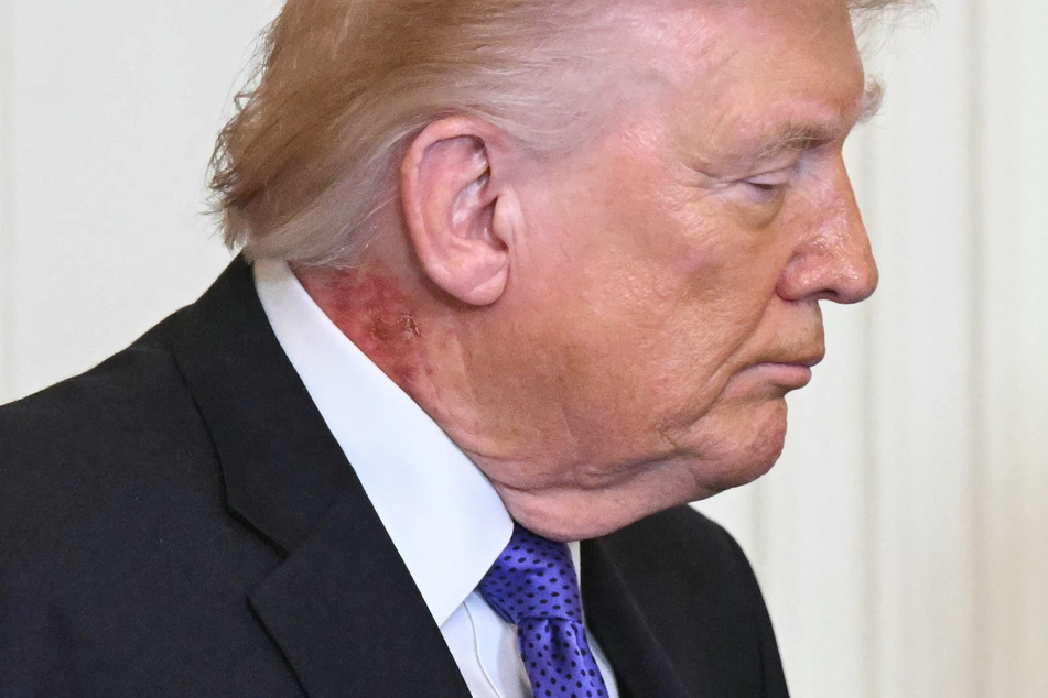 President Donald Trump looks on during a Medal of Honor ceremony in the East Room of the White House on March 2, 2026.