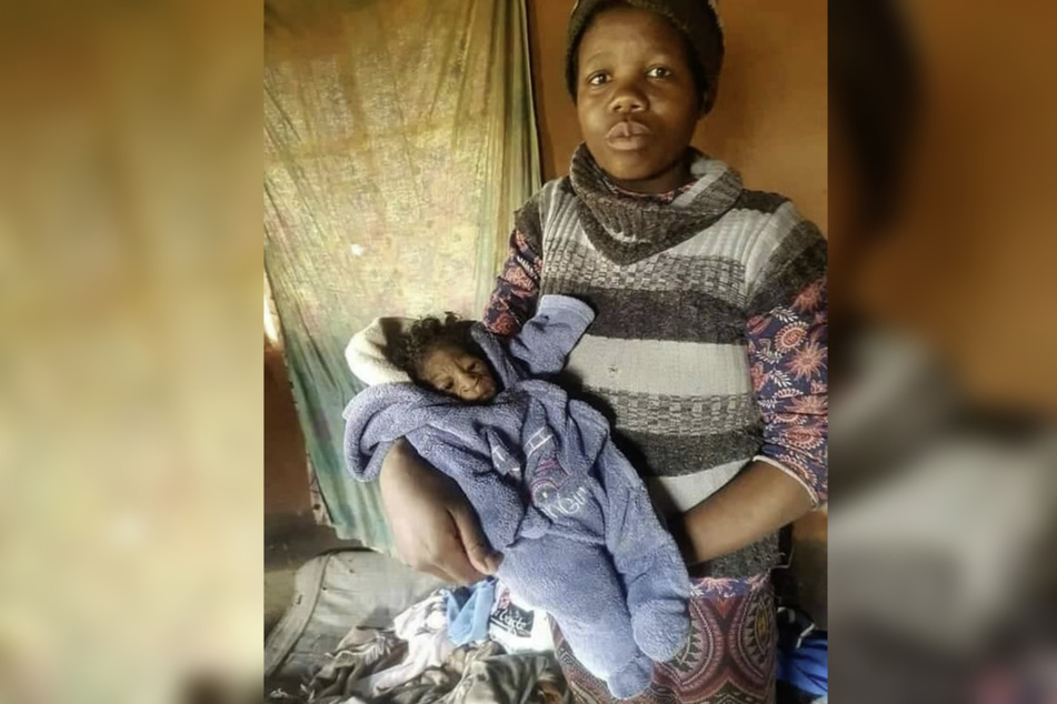 Despite her baby's rare illness, the 20-year-old loves her child more than anything.