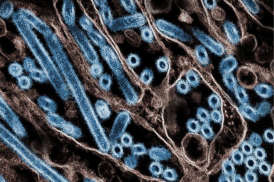 Child tests positive for bird flu infection – the first in the US