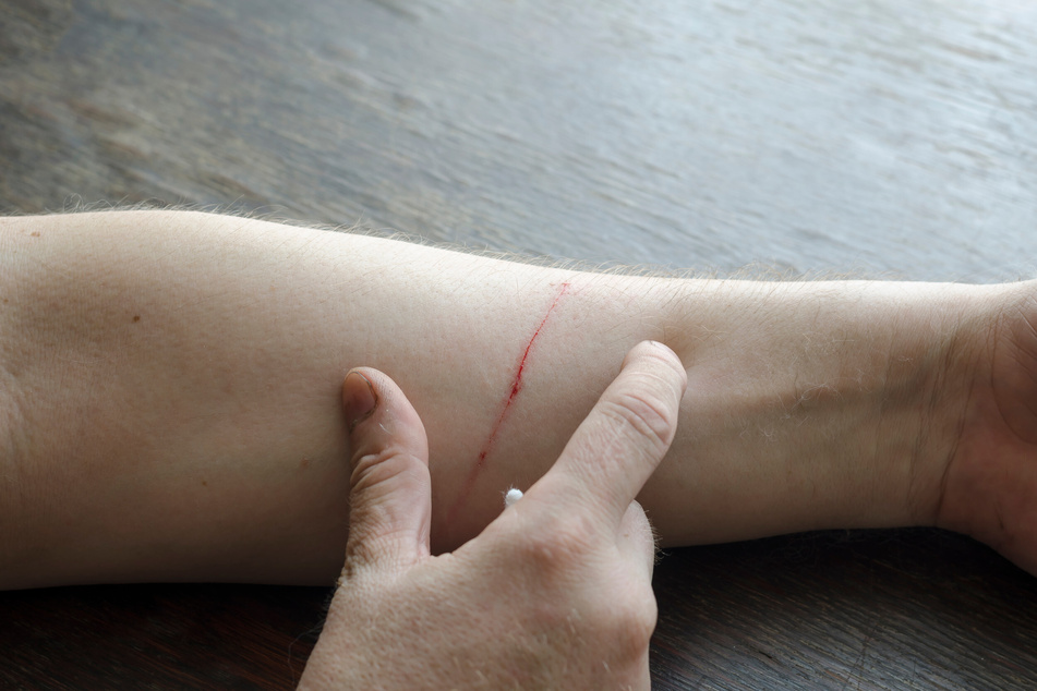 Even small cat claws can lead to painful scratches.