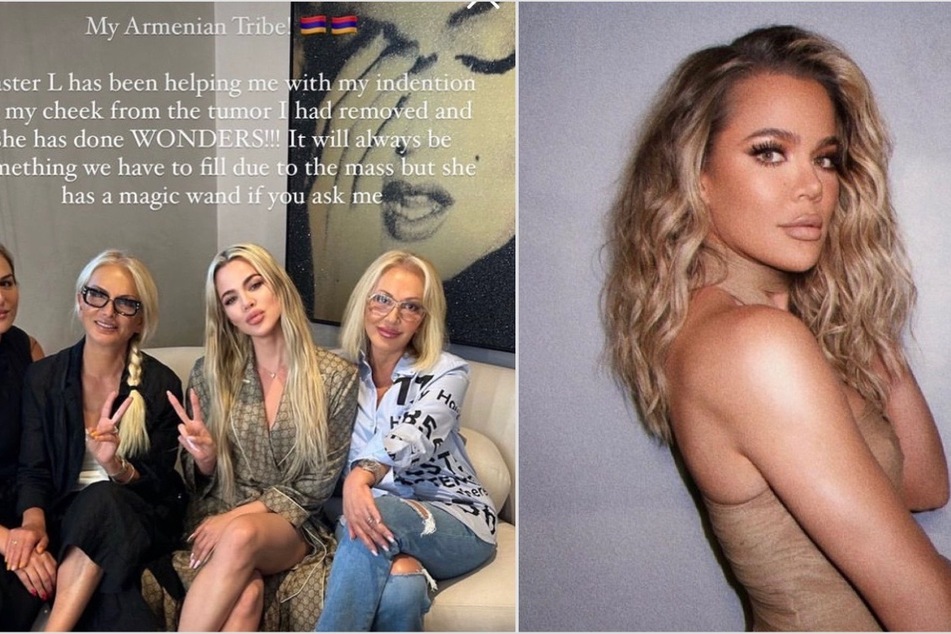 Khloé Kardashian reveals lasting impact of skin cancer scare