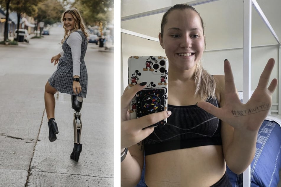 Alyssa Cleland, an influencer with no middle fingers and a prosthetic leg, aims for the 2025 Paralympics