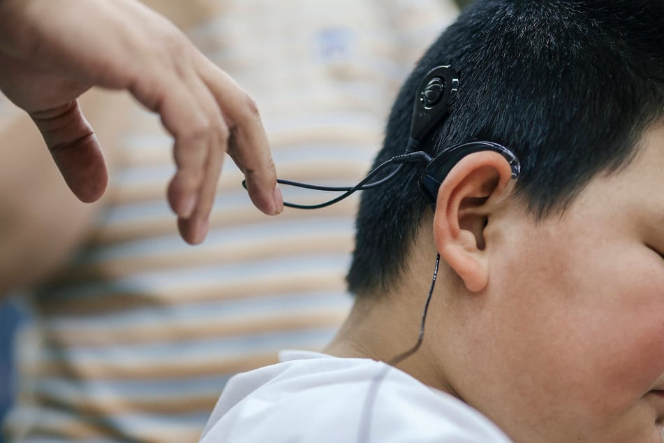 The new gene therapy could be used instead of a cochlear implant as a treatment option for children born deaf.