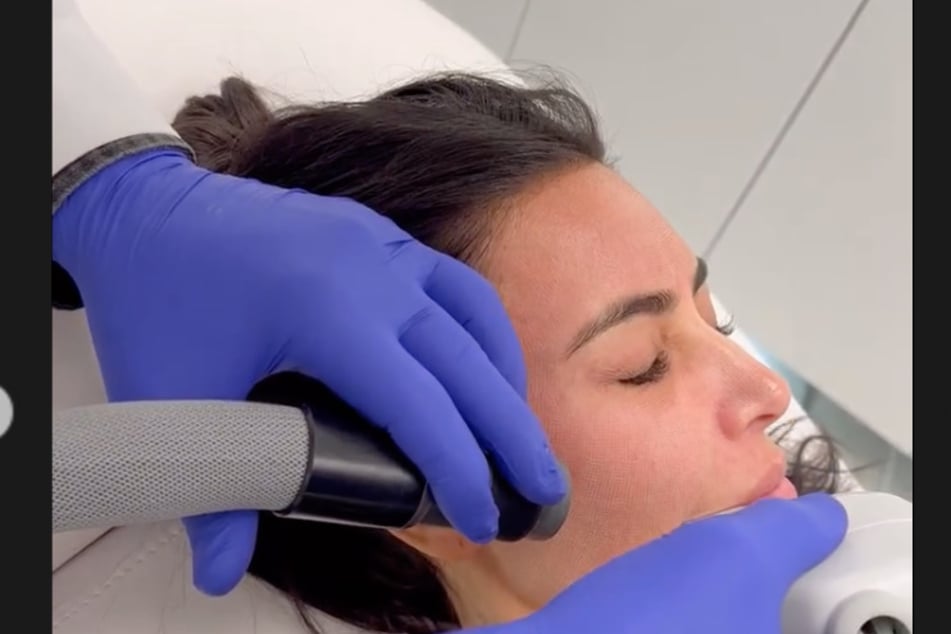 Kim Kardashian gets a laser treatment done to her face during her "beauty day" over the weekend.