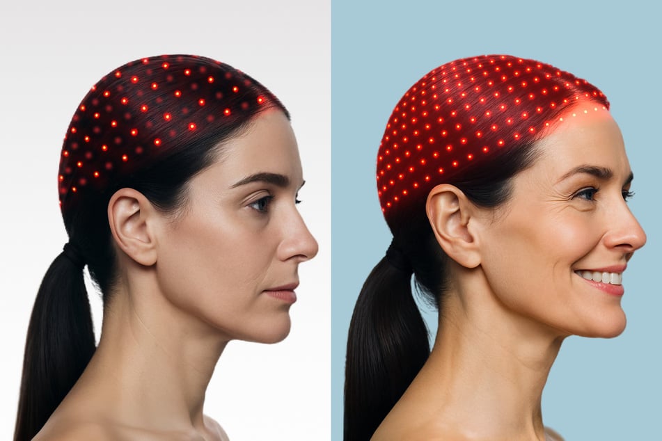 Walmart steal: How to treat hair loss without the steep pricetag? This FDA-cleared gadget is now $100 off