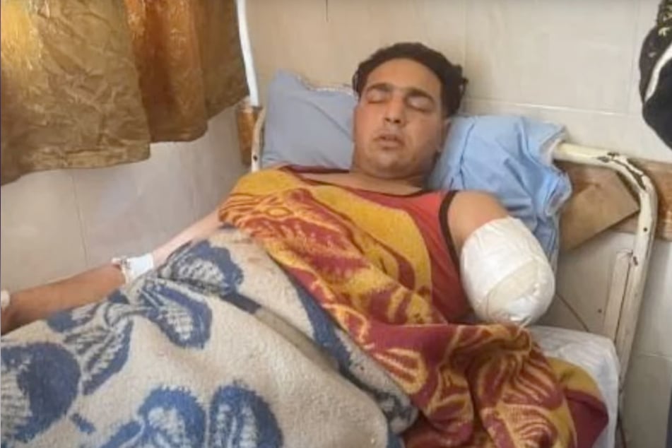 Mohammed (23) lost his left arm in the tiger attack.