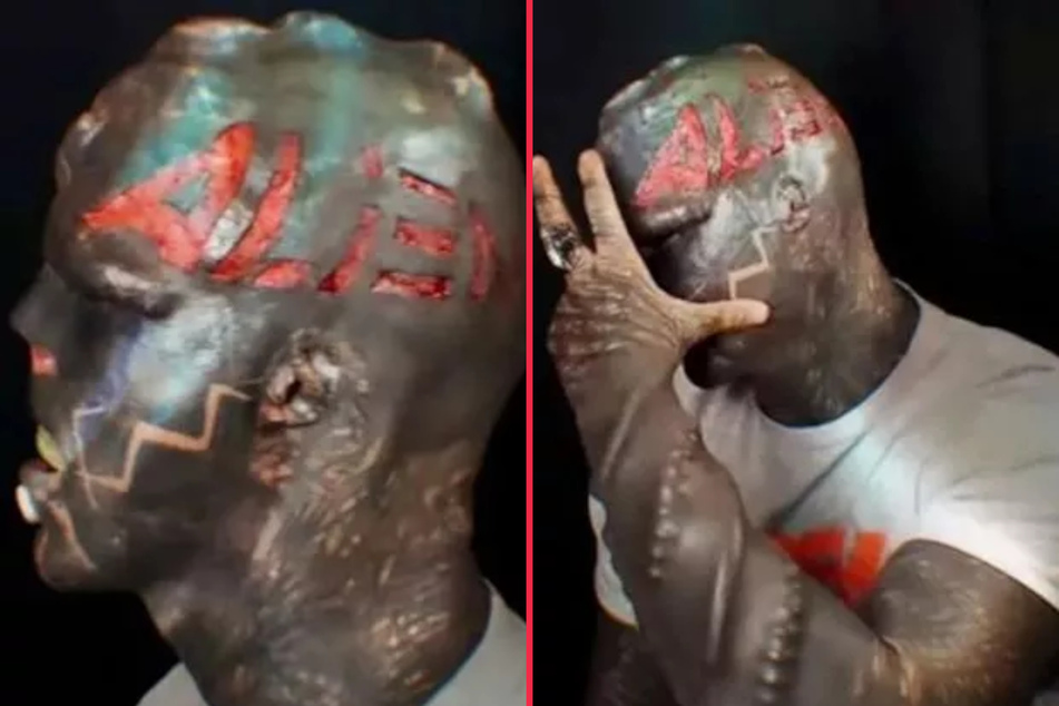 Anthony Loffredo has scalped his nickname onto his head.