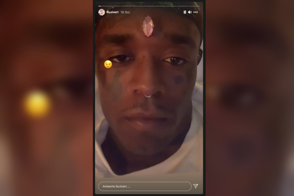 Lil Uzi Vert (26) got a new gawdy piercing.