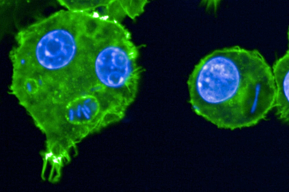 This handout microscope image taken in 2024 and released by the Institut Pasteur on May 27, 2025 shows Macrophages infected by Yersinia pestis bacteria.