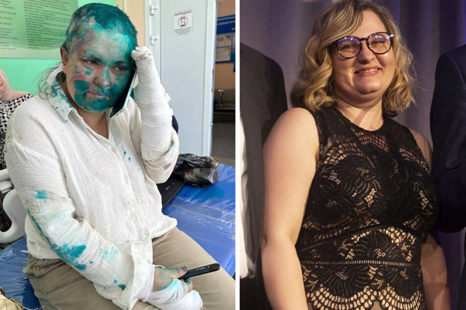 Russian reporter Elena Milashina "savagely" beaten in Chechnya