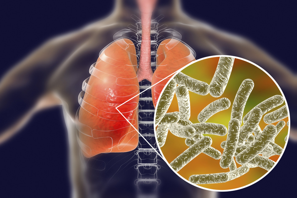NYC Legionnaires' disease outbreak kills five and sickens more