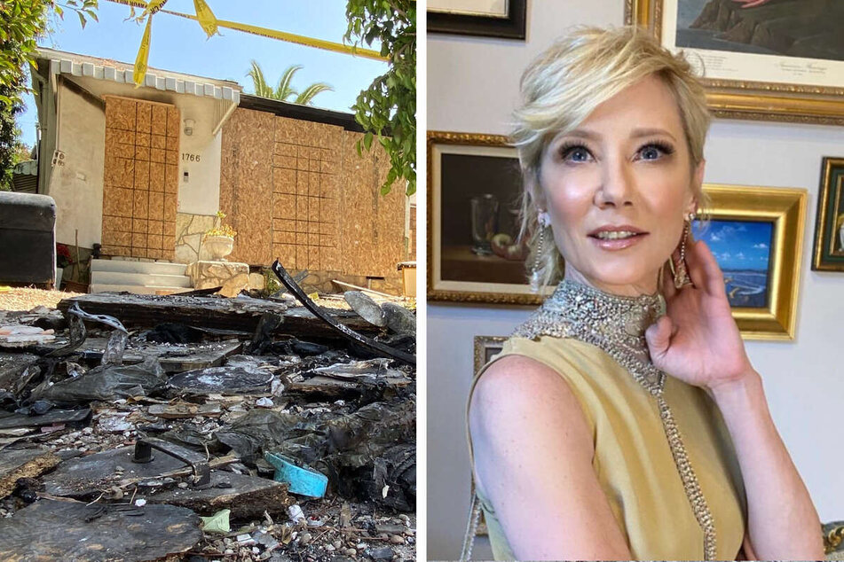 Anne Heche's official cause of death revealed after tragic car crash