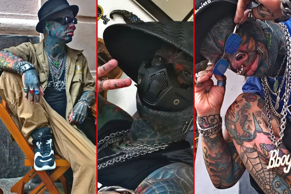 Marcelo "B-Boy" De Souza Ribeiro took his extreme body modification journey to the next level with his latest move.
