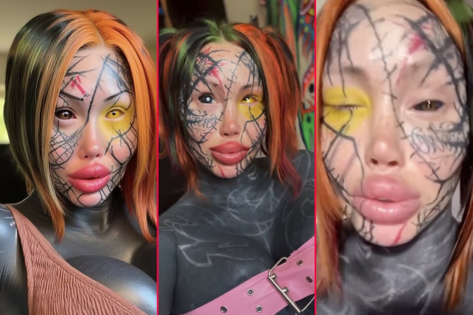Mary Magdalene, a model and social media influencer, had her eyelid effectively glued shut by a botched eye tattoo procedure.