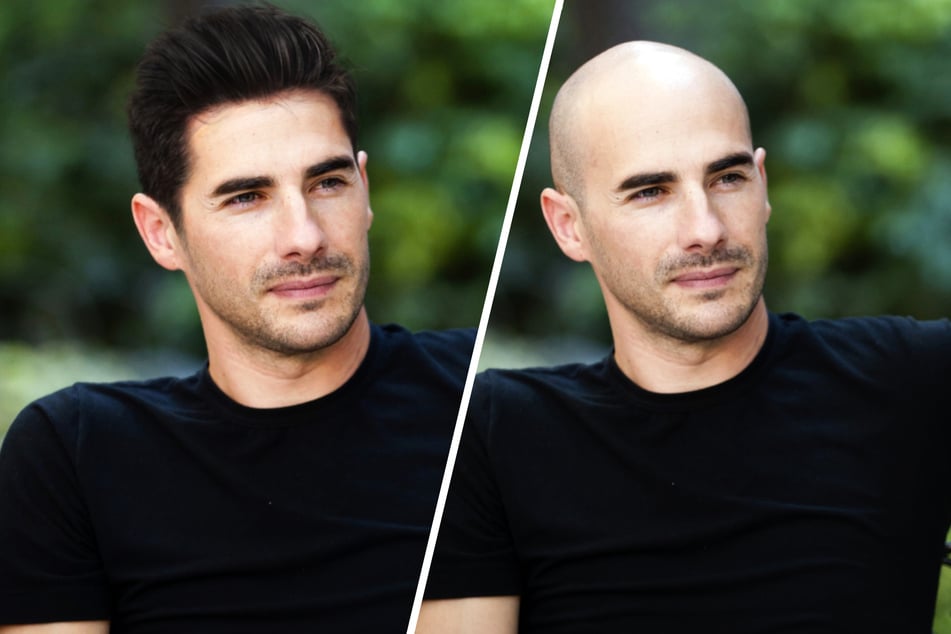 Christian had many matches both with and without hair.