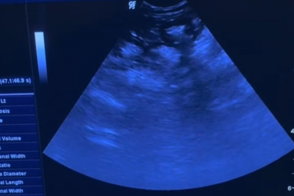 The ultrasound revealed that this cat was full of food!
