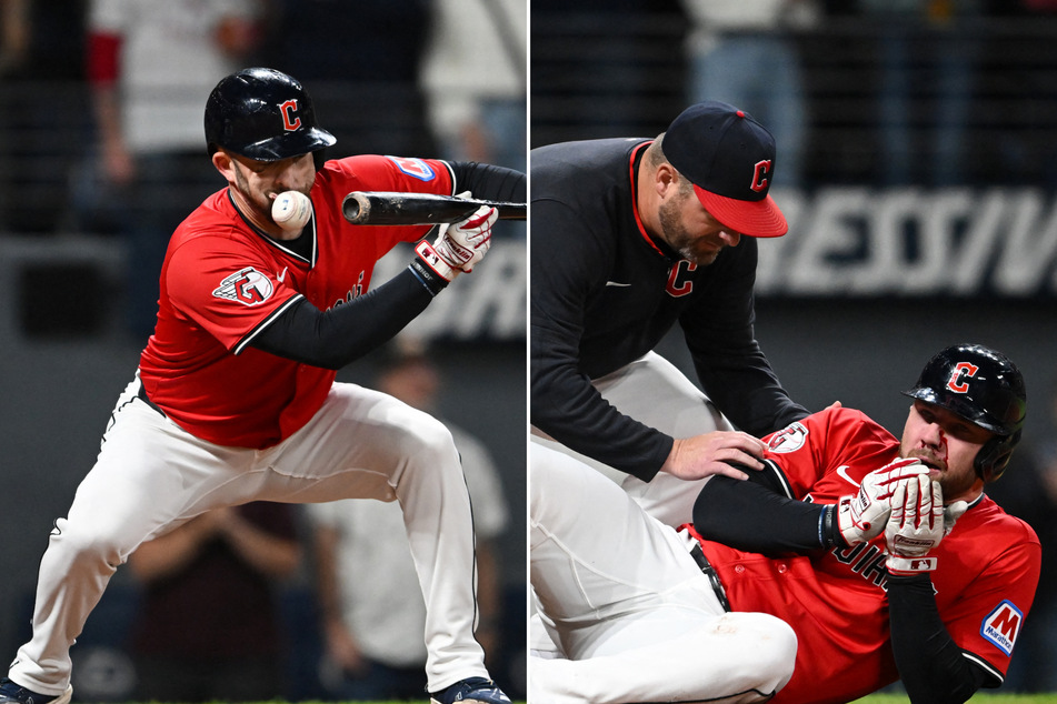 David Fry suffered multiple facial fractures after being hit by a pitch on Tuesday night.