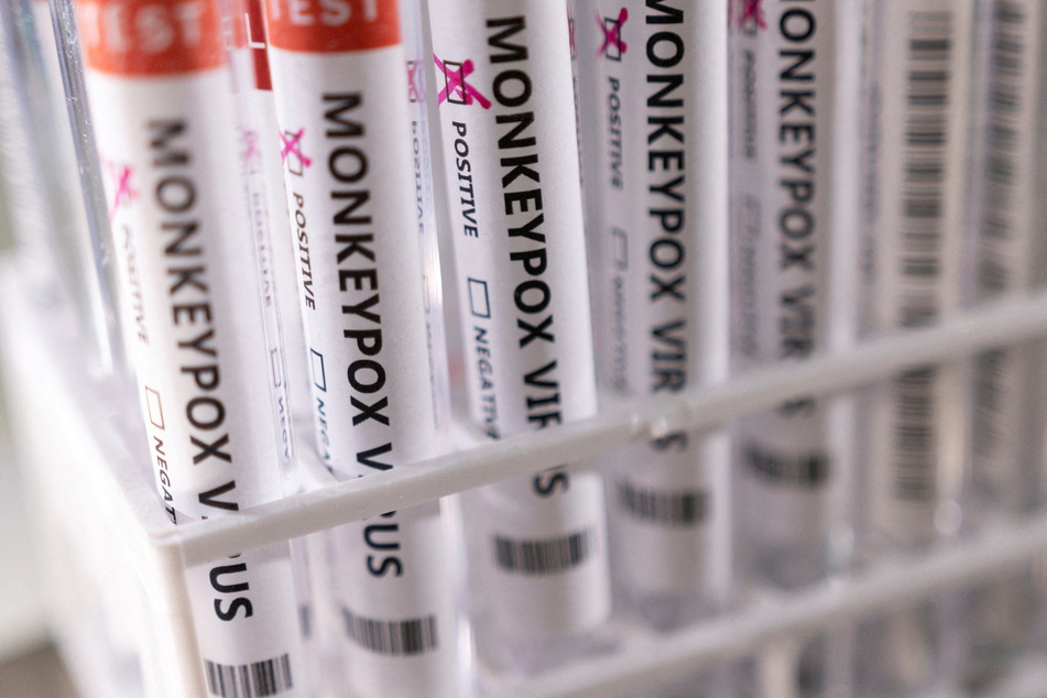 Monkeypox: What is it and how serious is the outbreak?