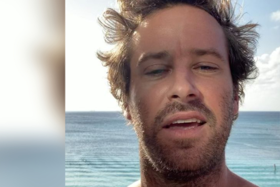 Amid cannibalism scandal, Armie Hammer faces dog abuse accusations