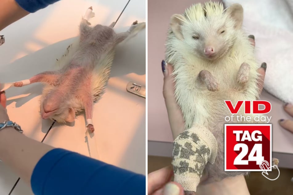 Viral Video of the Day for July 2, 2026: Tiny hedgehog melts hearts with the cutest custom cast ever!