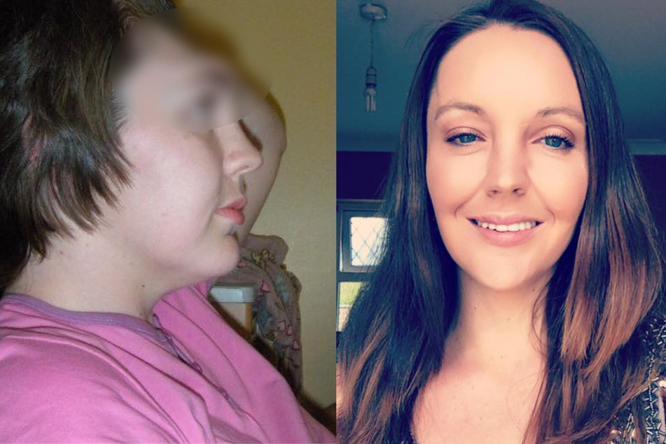 Woman who lost her forehead wants you to learn from her mistake
