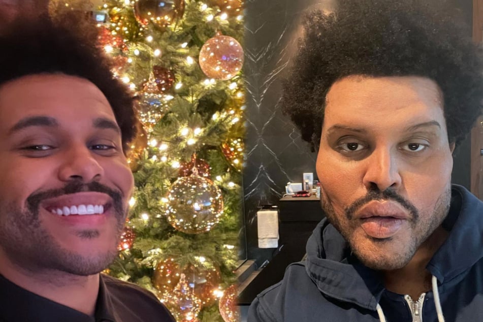 Before and after: a few weeks ago (l.) The Weeknd looked completely normal.